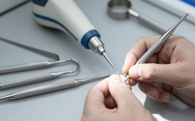 Best Dental Lab Equipment for In-Office Crown & Bridge